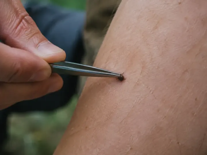 Comment enlever une tique en toute sécurité, étape par étape ?