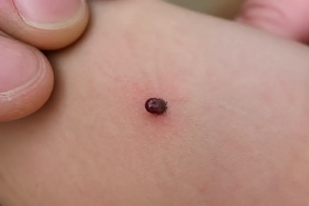 Petit parasite gorgee de sang colle a la peau